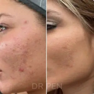 Sophie M., 34 ans - Paris · Grain de peau affiné · 6 semaines